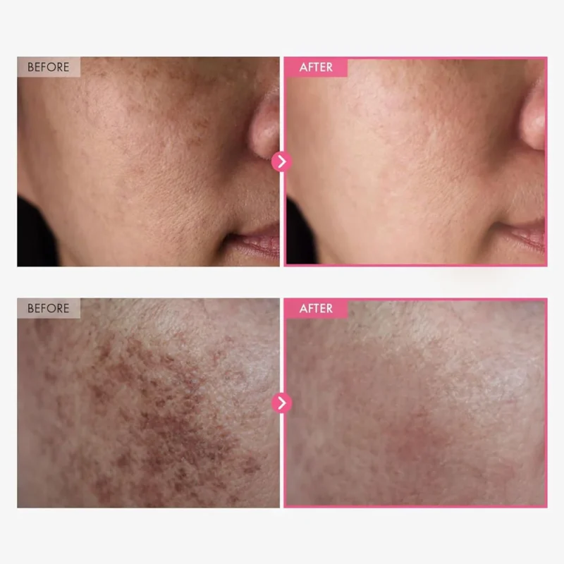 arbutin_cream_2