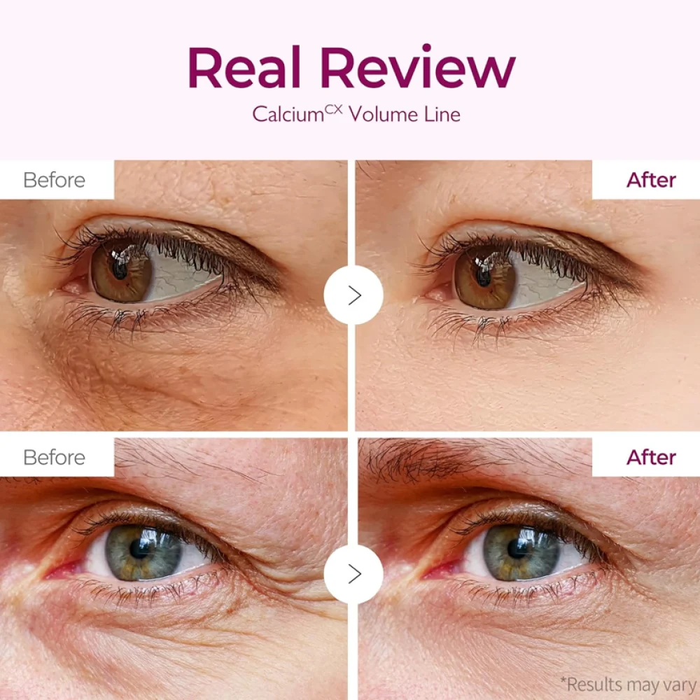 Dr. Melaxin Cemenrete Calcium Volume Eye Patch 60 Patches – Image 4
